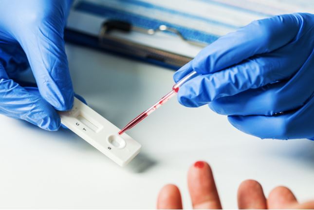 Toscana, Elisa Montemagni (Lega): ”Ritardi nei tamponi, dopo le nostre sollecitazioni finalmente si parte con i test&nbsp;rapidi”