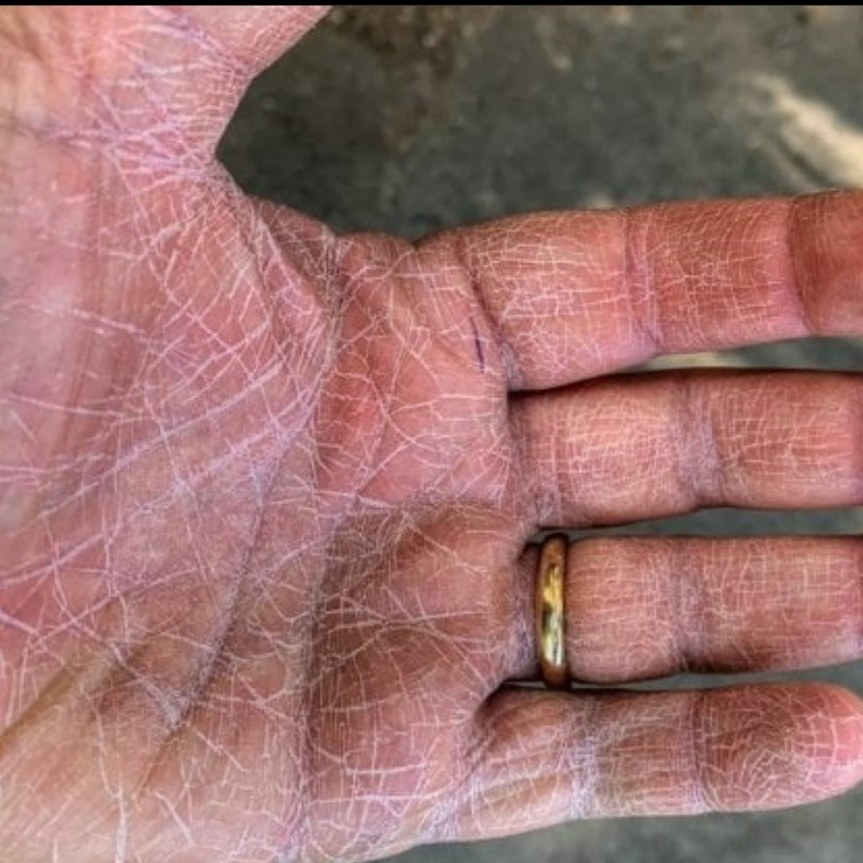 Siena: Covid, la foto della mano di un anestesista delle Scotte diventa&nbsp;“virale”