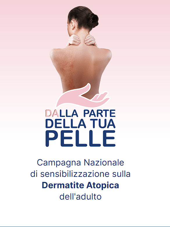 Siena: Dermatite atopica, tornano gli open&nbsp;day