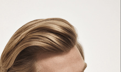 Siena: Trapianto capelli: a chi rivolgersi, chi può ricorrervi e come viene&nbsp;effettuato